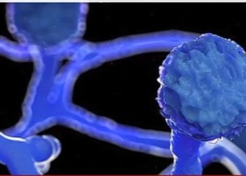 ബ്ലാക്ക്-ഫംഗസ്:-icu-കള്‍-പരിശോധിക്കണം;-ആരോഗ്യ-വകുപ്പ്-മാര്‍ഗനിര്‍ദേശം-പുറത്തിറക്കി