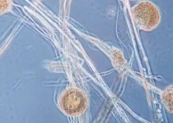 ഉത്തരാഖണ്ഡിൽ-ബ്ലാക്ക്‌-ഫംഗസ്‌-ബാധിച്ച്‌-ആദ്യ-മരണം