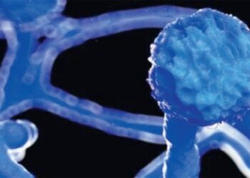 ബ്ലാക്ക്‌-ഫംഗസ്‌:-കോവിഡ്‌- ബാധിക്കാത്ത-ഒരാളും-ചികിത്സയിൽ