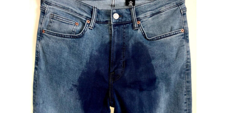 ജീൻസിൽ-മൂത്രമൊഴിച്ചത്-പോലെ-തോന്നിയോ!-എന്നാൽ-സത്യം-മറ്റൊന്നാണ്