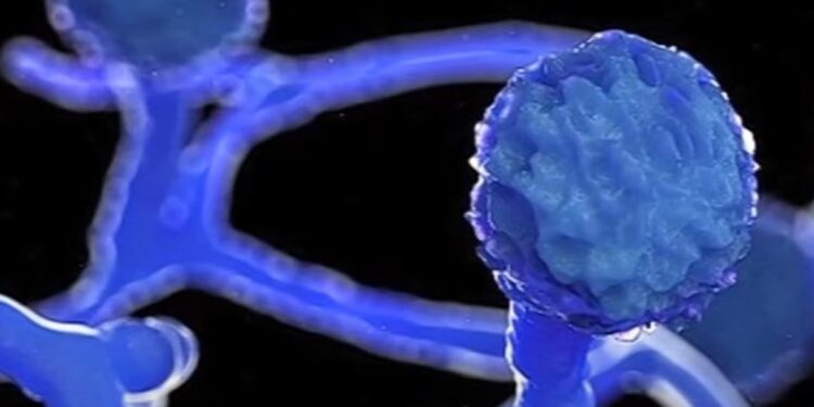 ബ്ലാക്ക്-ഫംഗസ്-ബാധിച്ച്-ചികിത്സയിലായിരുന്ന-വീട്ടമ്മ-മരിച്ചു