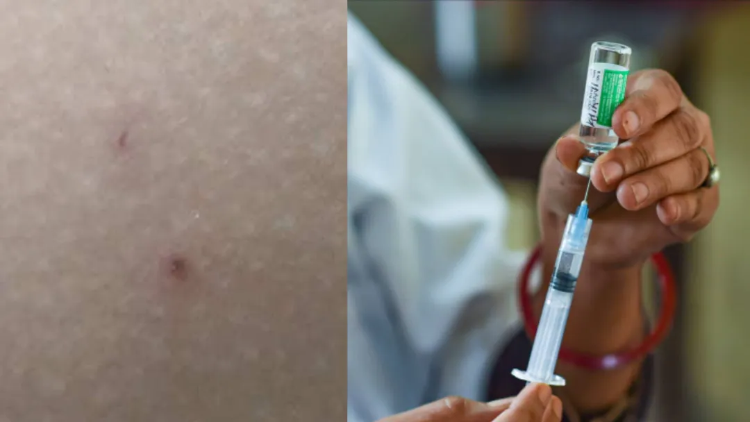 കോഴിക്കോട്ട്‌-വാക്‌സിന്‍-എടുത്ത-യുവതി-കുഴഞ്ഞുവീണു:-തുടരെ-രണ്ടുഡോസ്-നല്‍കിയെന്ന്-പരാതി