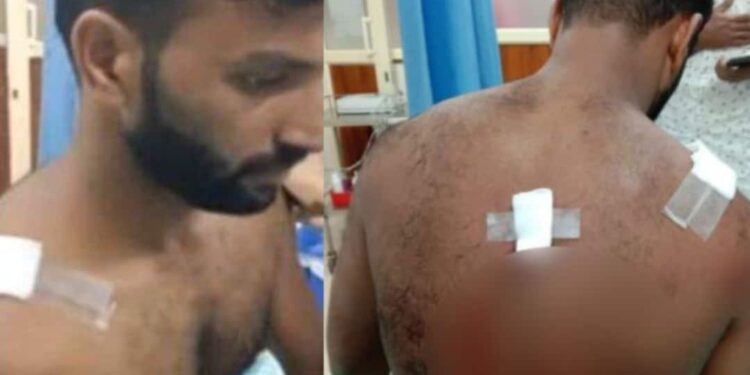 പാലക്കാട്-ടാപ്പിങ്-തൊഴിലാളിക്ക്-നേരെ-കടുവയുടെ-ആക്രമണം