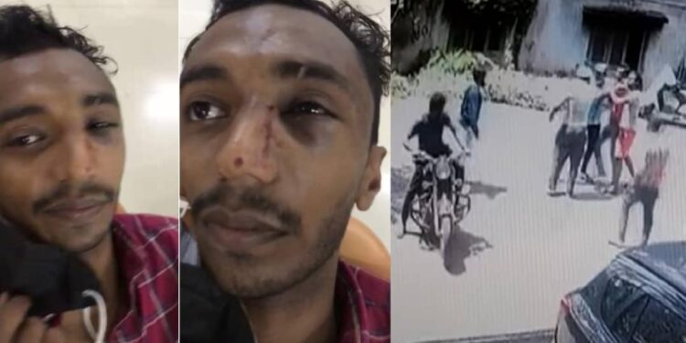 കട്ടിയുള്ള-വസ്തുകൊണ്ട്-കണ്ണിലടിച്ചു,-മൂക്കിന്റെ-പാലം-പൊട്ടി;-ക്രൂരമര്‍ദ്ദനമേറ്റെന്ന്‌-റുജീഷ്