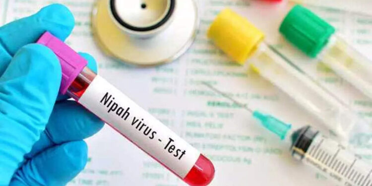 നിപ-വൈറസിനെ-പ്രതിരോധിക്കാൻ-എന്തൊക്കെയാണ്-ശ്രദ്ധിക്കേണ്ടത്?