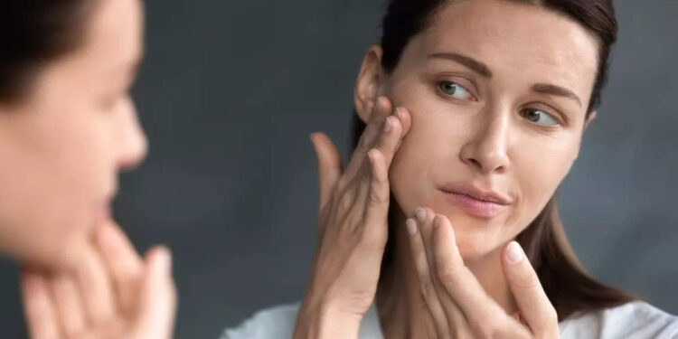 പിസിഒ.എസ്-ബാധിച്ച-സ്ത്രീകളിലെ-മുഖക്കുരു-അകറ്റാൻ-ഈ-കാര്യങ്ങൾ-ശ്രദ്ധിക്കാം