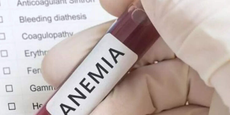 anemia-:-വിളർച്ച-തടയാൻ-ഇരുമ്പ്-അടങ്ങിയ-ഈ-ഭക്ഷണങ്ങൾ-വേണം-കഴിക്കാൻ