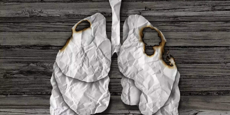 lung-cancer-:-ശ്വാസകോശ-അർബുദം:-ഈ-കാര്യങ്ങൾ-അവഗണിക്കരുത്