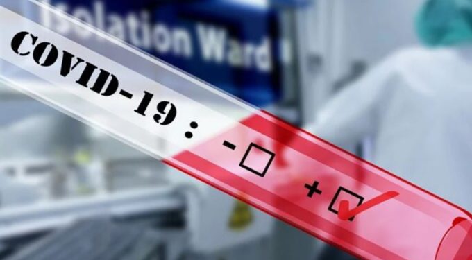 സംസ്ഥാനത്ത്-2748-പേർക്ക്-കൊവിഡ്-സ്ഥിരീകരിച്ചു;-33-മരണം