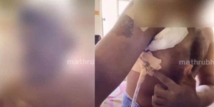 യുവാവിന്റെ-തല-കുപ്പികൊണ്ട്-അടിച്ച്‌പൊട്ടിച്ചു;-പിന്നില്‍-അച്ഛനേയും-മകളേയും-മര്‍ദിച്ച-ഗുണ്ടാസംഘം