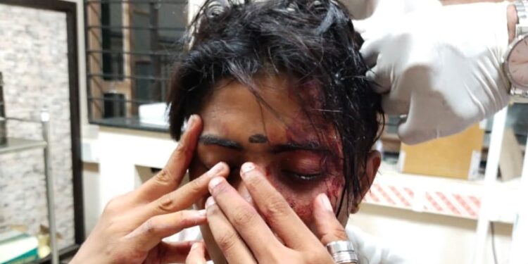 തിരുവനന്തപുരത്ത്-ട്രാന്സ്ജെന്ഡേഴ്സിന്-മര്ദനം;-മരക്കഷ്ണം-കൊണ്ട്-തല-അടിച്ചുപൊട്ടിച്ചു