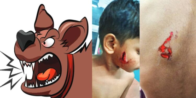 ആര്-തടയും-ഈ-വിളയാട്ടം;-മുറ്റത്തുനിന്ന-കുട്ടികളെ-തെരുവുനായ-ആക്രമിച്ചു-മുഖം-കടിച്ചുമുറിച്ചു