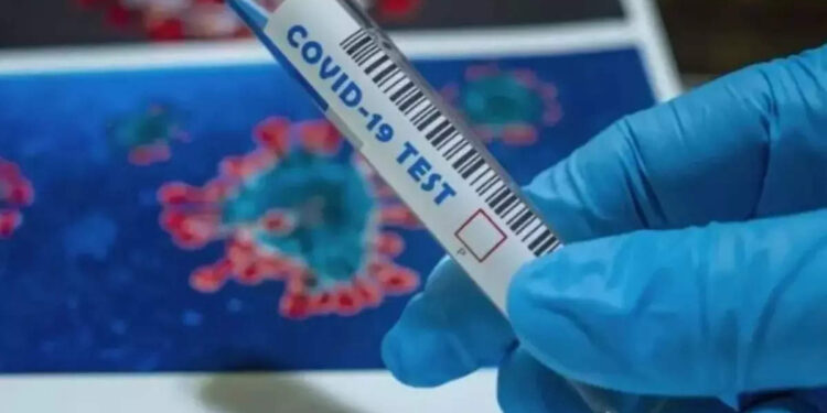 സംസ്ഥാനത്ത്-പ്രതിദിന-കൊവിഡ്-കേസുകൾ-കുറയുന്നു;-ഇന്ന്-രോഗബാധ-26,729-പേർക്ക്