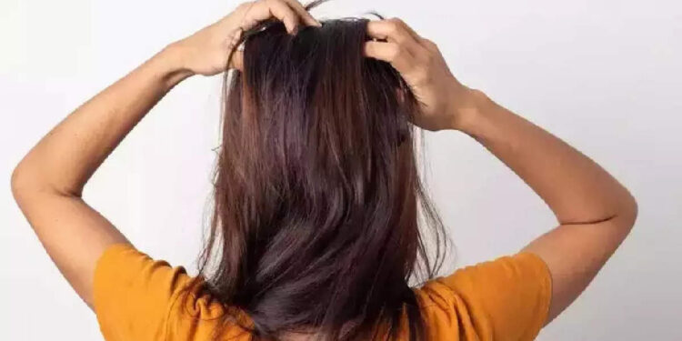 hair-lice:-തലയിലെ-പേന്‍-ശല്യമാണോ-നിങ്ങളുടെ-പ്രശ്‌നം;-പേടിക്കണ്ട-വീട്ടില്‍-തന്നെ-പരിഹാരം-കാണാം