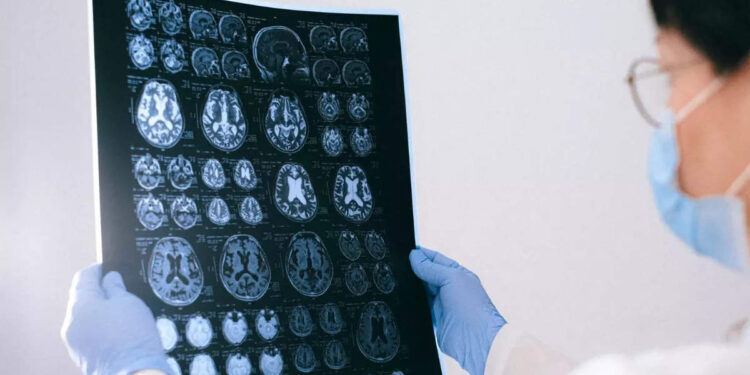 brain-tumor:-തലച്ചോറിലെ-മുഴ:-ലക്ഷണങ്ങളും-കാരണങ്ങളും