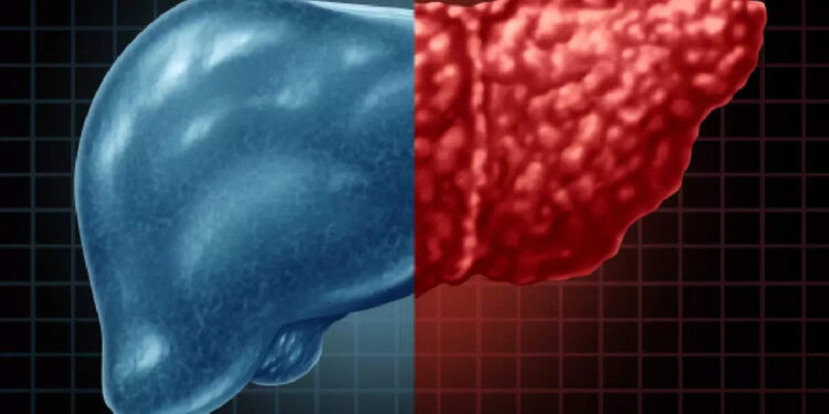നടക്കാൻ-ബുദ്ധിമുട്ട്-ഉണ്ടെങ്കിൽ-അത്-കരളിൻ്റെ-പ്രശ്നമാണോ?