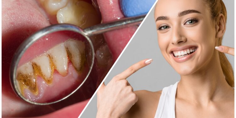 ​കറയും-പ്ലാക്കും-കളഞ്ഞ്-നല്ല-മുല്ലമുട്ട്-പോലെ-പല്ല്-തിളങ്ങാന്‍-എളുപ്പ-വഴികള്‍​