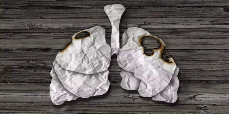 world-lung-cancer-day:-ലംഗ്‌സ്-ക്യാന്‍സറിന്-ചില-അറിയാക്കാരണങ്ങള്‍