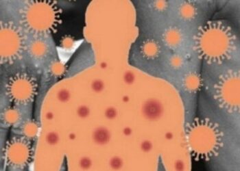 പാകിസ്ഥാനിൽ-വീണ്ടും-എംപോക്സ്‌